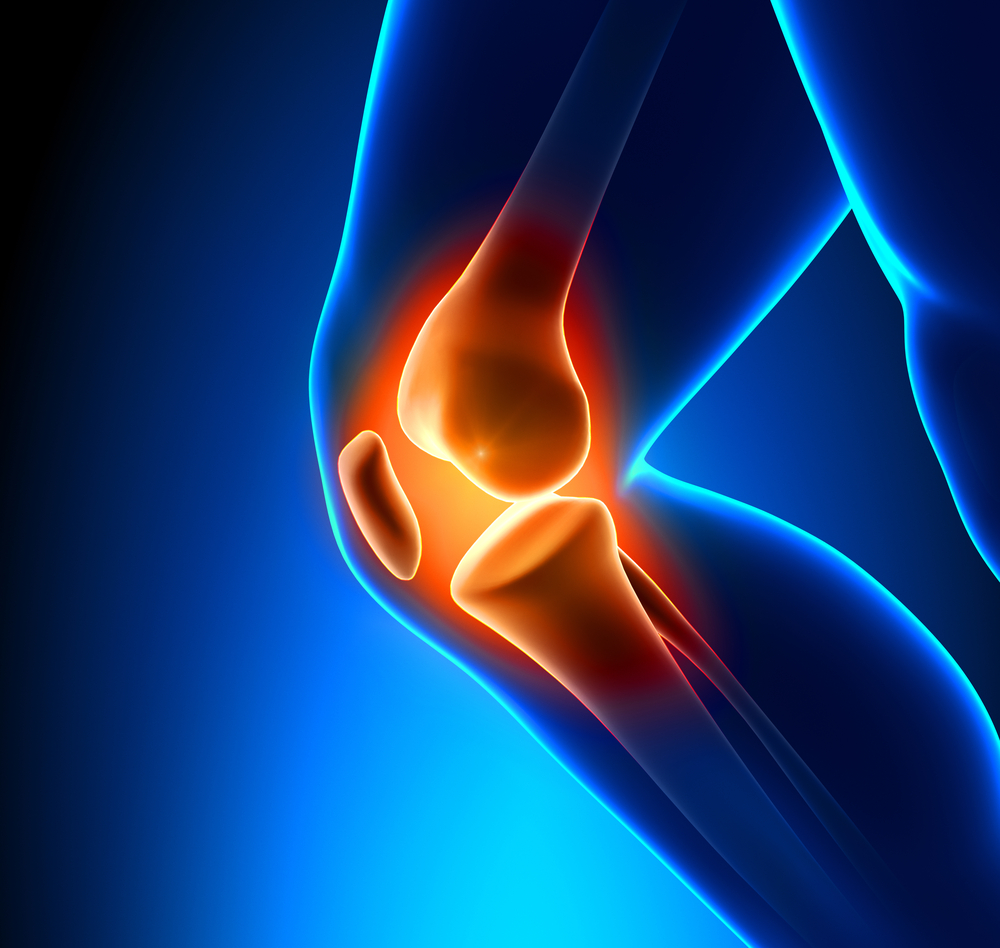 Intra-Articular Injection