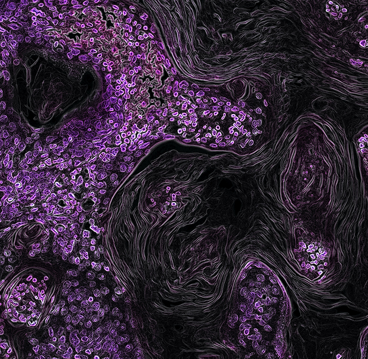 PCa GnRH Agonists Simulator